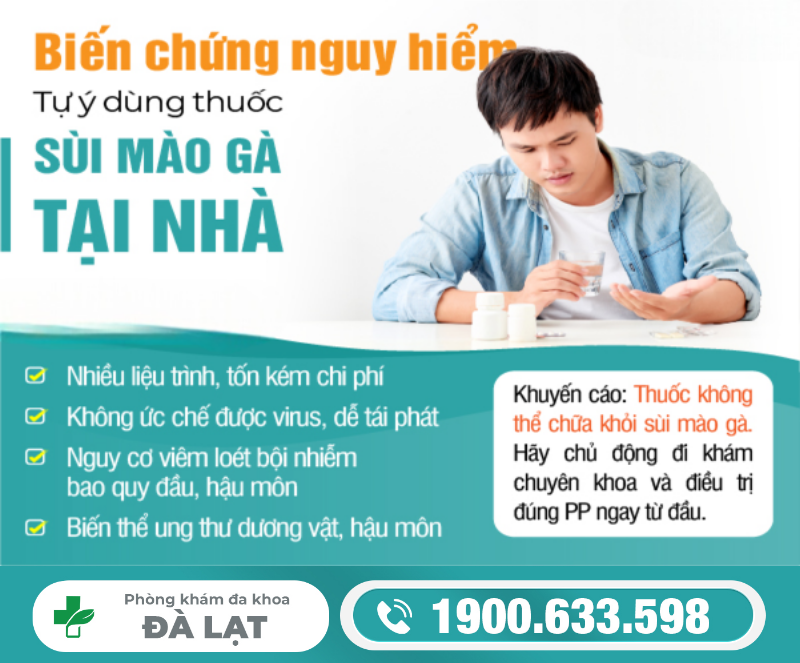 Hình ảnh minh họa